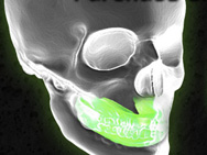 shock-doctor-mouth-guard